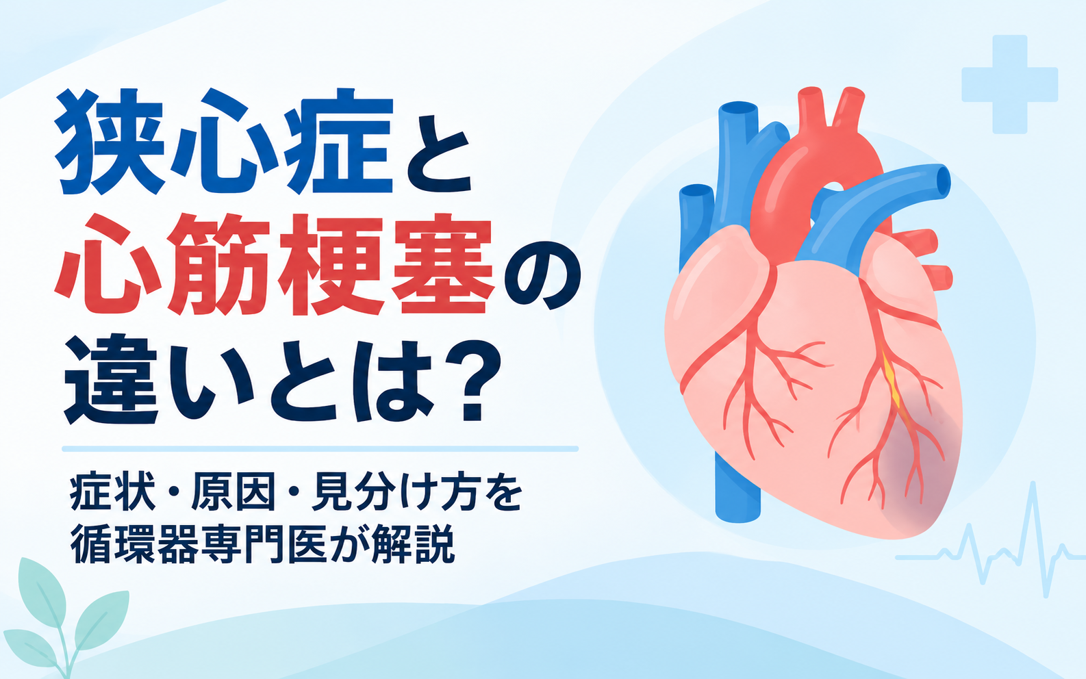 狭心症と心筋梗塞の違いを解説する記事のアイキャッチ画像。左にタイトル、右に心臓のイラストを配置し、冠動脈の一部とその先の傷んだ心筋を示したシンプルなベクター画像。
