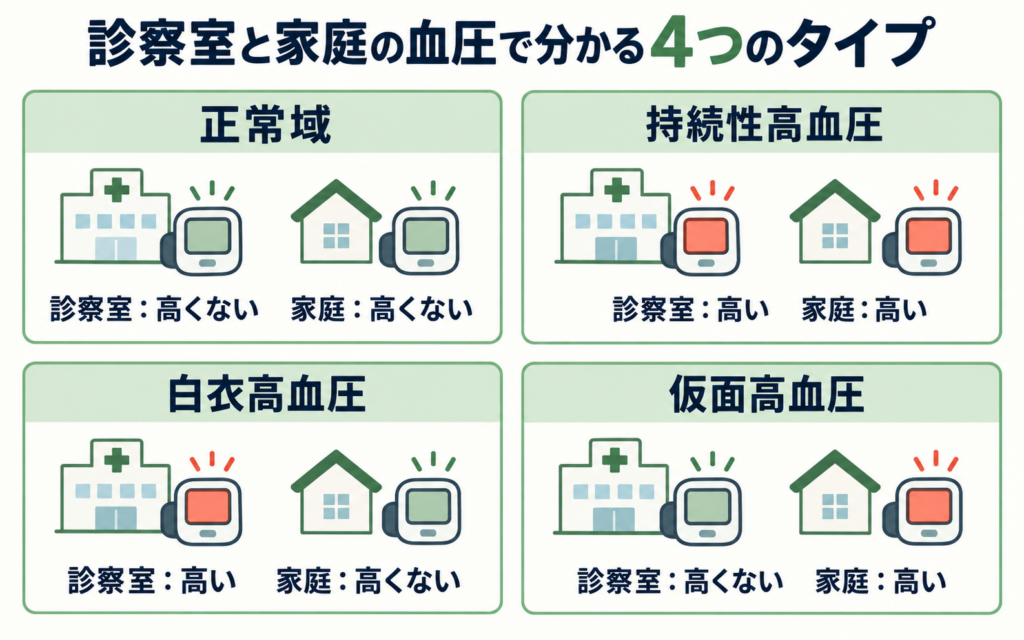 診察室血圧と家庭血圧の高低の組み合わせから分かる4つのタイプ(正常域・持続性高血圧・白衣高血圧・仮面高血圧)を、病院と家のアイコンで示した図解