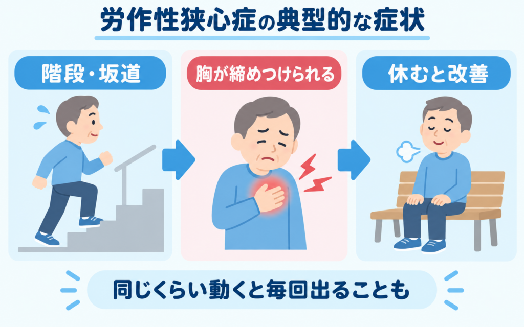 労作性狭心症の典型的な症状の流れを示すイラスト。階段や坂道を上るなど体を動かしたときに胸が締めつけられるように痛み、休むと症状が改善することを表している。
