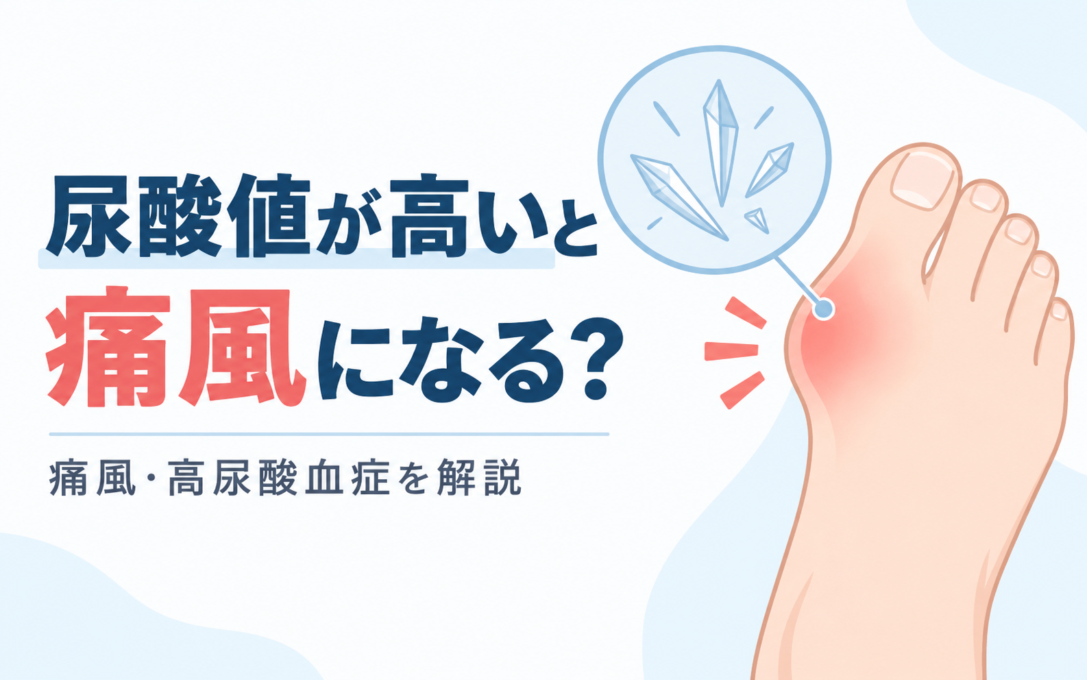尿酸値が高いと痛風になる？痛風・高尿酸血症の症状と治療を解説するアイキャッチ画像。赤く腫れた足の親指の付け根と尿酸結晶のイラストを示す