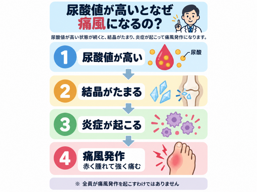 尿酸値が高いとなぜ痛風になるのかを示す図解。尿酸値が高い状態が続くと結晶がたまり、炎症が起こって痛風発作に至る4段階の流れを示す。全員が痛風発作を起こすわけではないことも注記