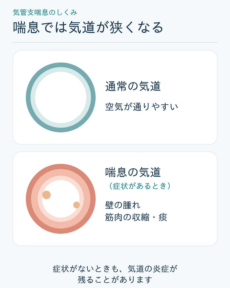 気管支喘息のしくみを示す図解。通常の気道は空気が通りやすいが、喘息の気道は症状があるとき壁の腫れ・筋肉の収縮・痰で狭くなり、症状がないときも炎症が残ることがある