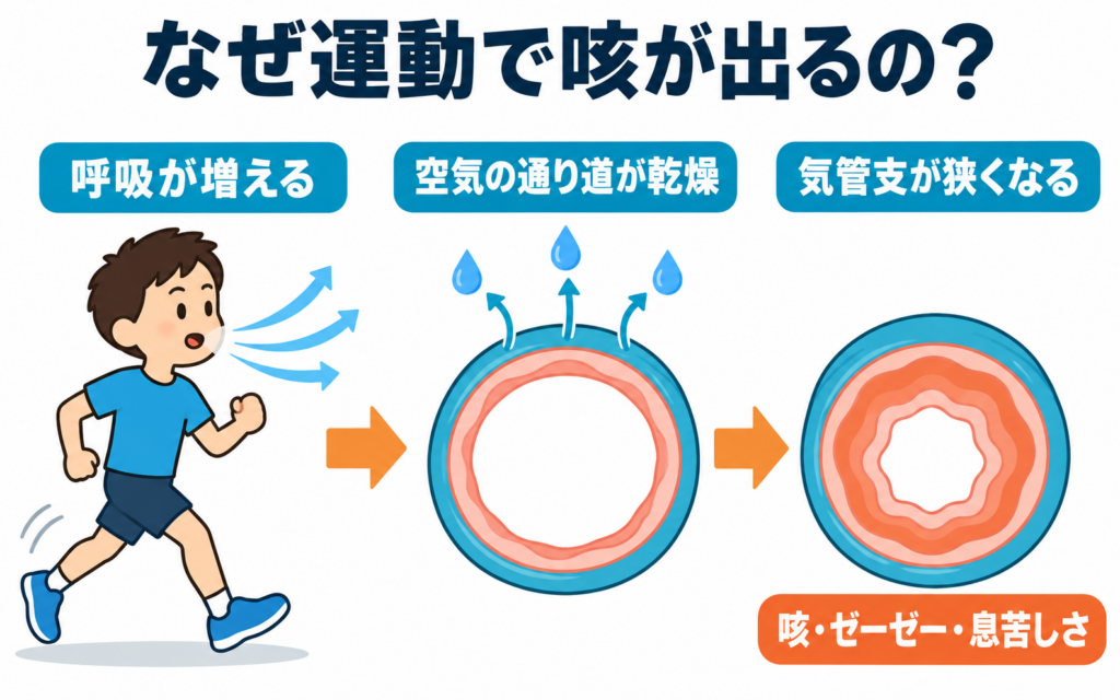 運動誘発喘息の仕組みの図。運動で呼吸が増えると空気の通り道が乾燥し、気管支が狭くなって咳・ゼーゼー・息苦しさが出る
