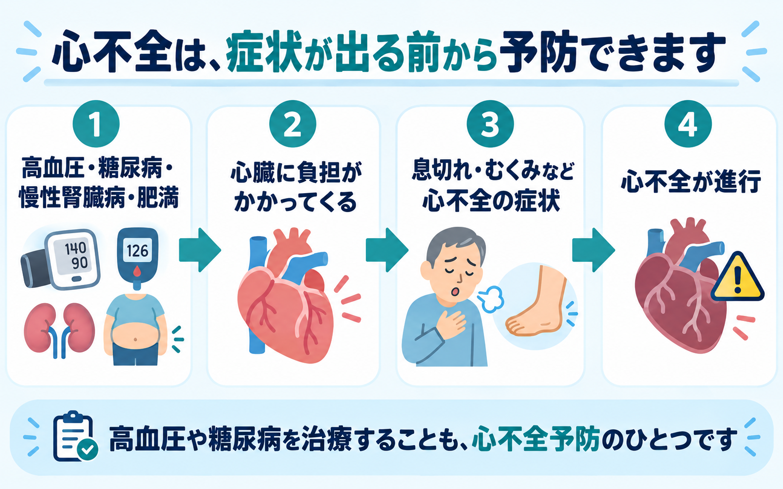 心不全は症状が出る前から予防できることを示す4段階の図。①高血圧・糖尿病・慢性腎臓病・肥満などの危険因子→②心臓に負担がかかる→③息切れ・むくみなど心不全の症状が出る→④心不全が進行する、という流れを表しており、高血圧や糖尿病の治療自体が心不全予防になることを伝えている。