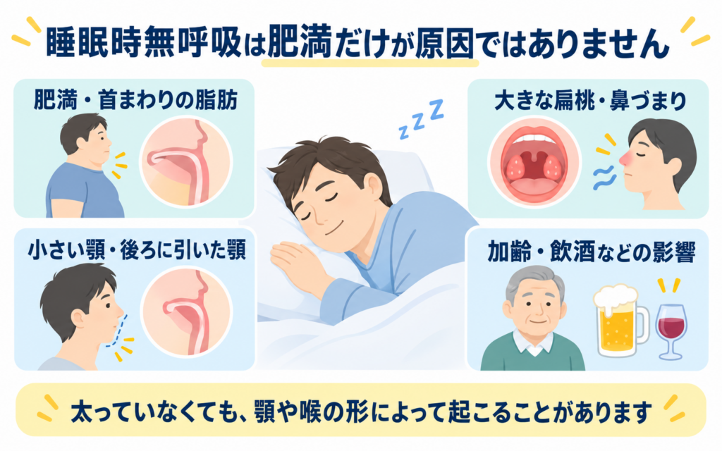 肥満・首まわりの脂肪、小さい顎・後ろに引いた顎、大きな扁桃・鼻づまり、加齢・飲酒など、肥満以外にもある睡眠時無呼吸症候群のなりやすい要因を示した図解