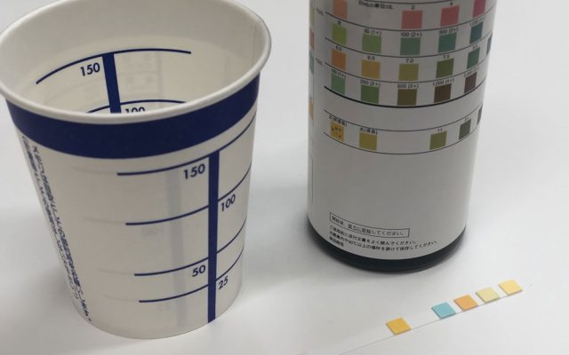 尿検体容器(採尿カップ)と尿試験紙、判定用カラーチャートを並べた写真。尿糖・尿蛋白などの検査項目ごとに、試験紙の色の変化で結果を判定する仕組みを示している