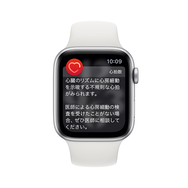 Apple Watchに表示される「心臓のリズムに心房細動を示唆する不規則な心拍がみられます」という通知画面のスクリーンショット。医師による心房細動の検査を受けたことがない場合は相談するよう案内している。