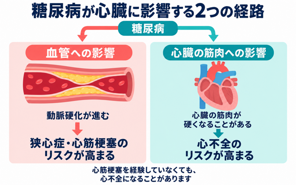 糖尿病が心臓に影響する2つの経路を示した図。血管への影響では動脈硬化が進み、狭心症・心筋梗塞のリスクが高まる。心臓の筋肉への影響では、心臓の筋肉が硬くなることがあり、心不全のリスクが高まる。心筋梗塞を経験していなくても、心不全になることがある